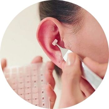 Auriculoterapia
